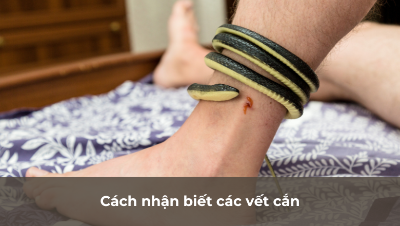 cách nhận biết vết cắn