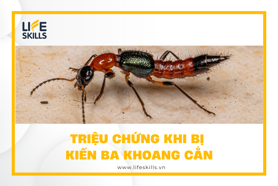 Triệu chứng khi bị kiến ba khoang cắn