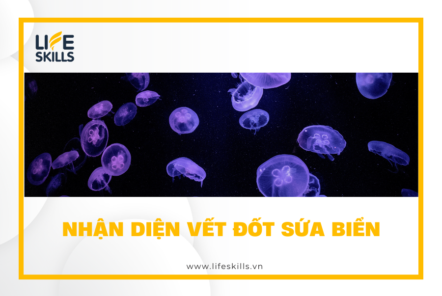 Nhận diện vết đốt sứa biển