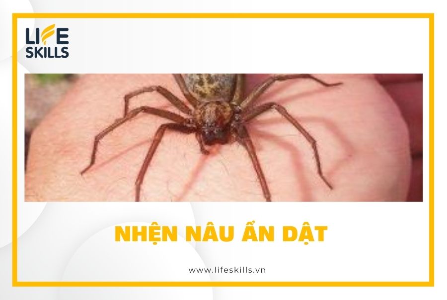 Nhện nâu ẩn dật - Brown Recluse spider